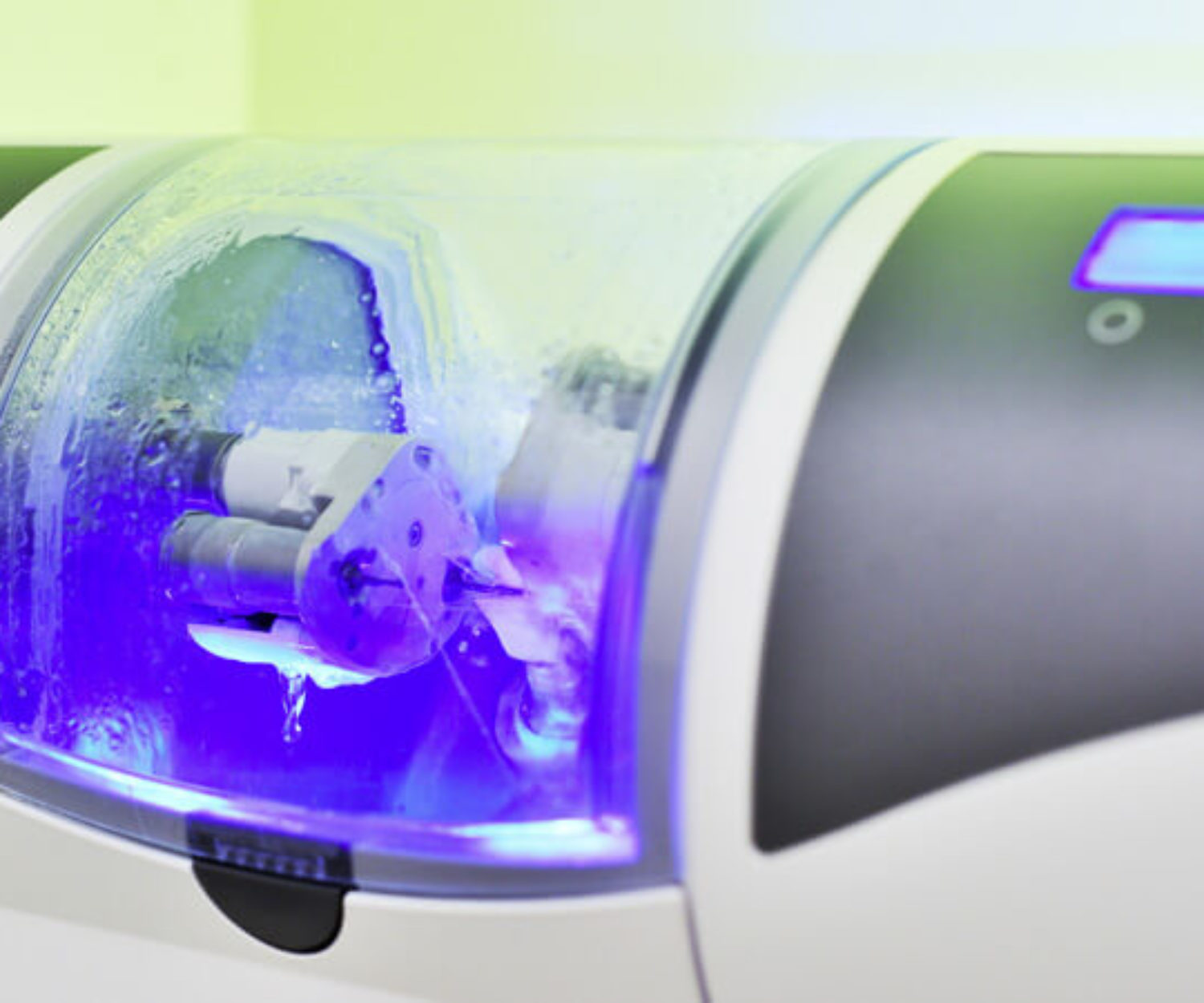 Kronen und Inlays - Zahnärzte Konstanz - Private Zahnarztpraxis Konstanz