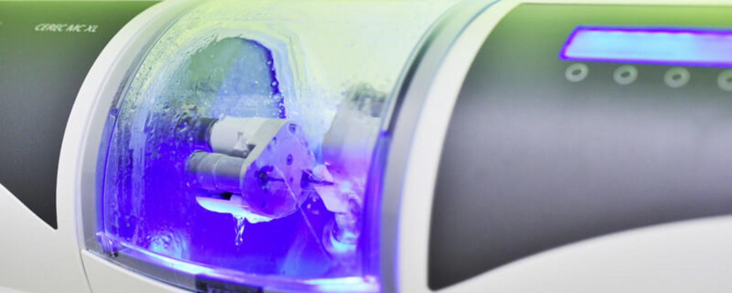 Kronen und Inlays - Zahnärzte Konstanz - Private Zahnarztpraxis Konstanz