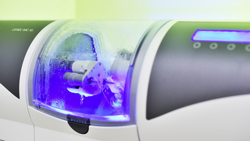 Kronen und Inlays – Zahnärzte Konstanz Kronen und Inlays - Zahnärzte Konstanz - Private Zahnarztpraxis Konstanz